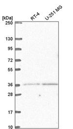 LDB2 Antibody in Western Blot (WB)