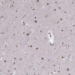 RRAGD Antibody in Immunohistochemistry (IHC)