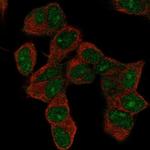 HOXD9 Antibody in Immunocytochemistry (ICC/IF)