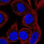 CYP27C1 Polyclonal Antibody