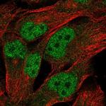 LINC00493 Polyclonal Antibody