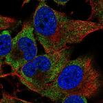 PIM3 Antibody in Immunocytochemistry (ICC/IF)
