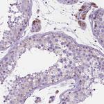 CECR6 Antibody in Immunohistochemistry (IHC)