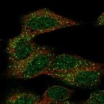 CECR6 Polyclonal Antibody