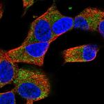 COQ10A Polyclonal Antibody