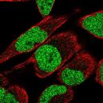 MTF2 Polyclonal Antibody