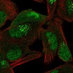 CAND1 Polyclonal Antibody