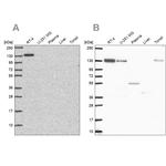CAND1 Antibody in Western Blot (WB)