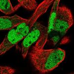 MTF2 Polyclonal Antibody