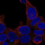 ZNF747 Polyclonal Antibody