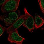 LRR1 Polyclonal Antibody