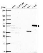 LRR1 Antibody in Western Blot (WB)