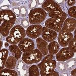 TM4SF18 Antibody in Immunohistochemistry (IHC)