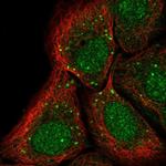 PTPRA Polyclonal Antibody