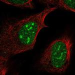 FAM133B Polyclonal Antibody