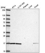 GPR177 Antibody in Western Blot (WB)