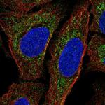 MTERF Polyclonal Antibody