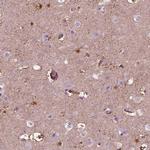 GDF11 Polyclonal Antibody