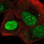 C3orf17 Polyclonal Antibody