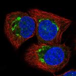 ATP2C1 Antibody in Immunocytochemistry (ICC/IF)