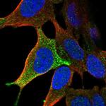 LHFPL3 Polyclonal Antibody
