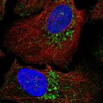 WARS2 Polyclonal Antibody