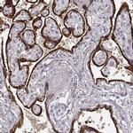 ARHGAP8 Antibody in Immunohistochemistry (IHC)
