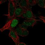 ARHGAP8 Polyclonal Antibody