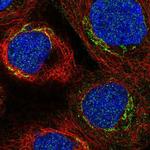 C3orf67 Polyclonal Antibody