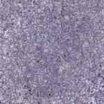 TMEM48 Polyclonal Antibody