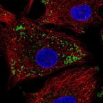 Krt222 Polyclonal Antibody