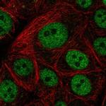 GTF3C5 Polyclonal Antibody