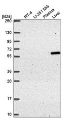 TIN2 Antibody in Western Blot (WB)
