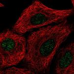 TMEM92 Polyclonal Antibody