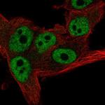 CNOT11 Polyclonal Antibody