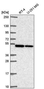 CNOT11 Antibody in Western Blot (WB)