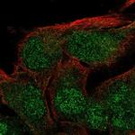 ZFYVE27 Antibody in Immunocytochemistry (ICC/IF)