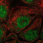 EFCAB1 Polyclonal Antibody