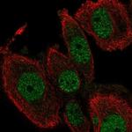 TEAD2 Polyclonal Antibody