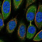 PRR5L Polyclonal Antibody