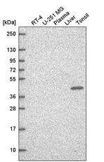 TFCP2 Antibody in Western Blot (WB)