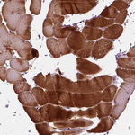 PPAPDC3 Antibody in Immunohistochemistry (Paraffin) (IHC (P))