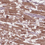 PPAPDC3 Antibody in Immunohistochemistry (Paraffin) (IHC (P))