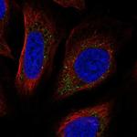 PPAPDC3 Polyclonal Antibody