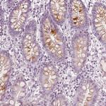 R3HDML Antibody in Immunohistochemistry (IHC)