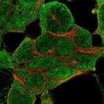 NSD1 Polyclonal Antibody