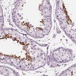 CYLC1 Antibody in Immunohistochemistry (IHC)