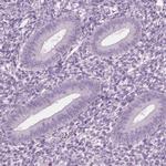CYLC1 Antibody in Immunohistochemistry (IHC)