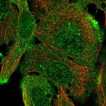 ARAP1 Polyclonal Antibody