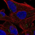 SLA/LP Polyclonal Antibody